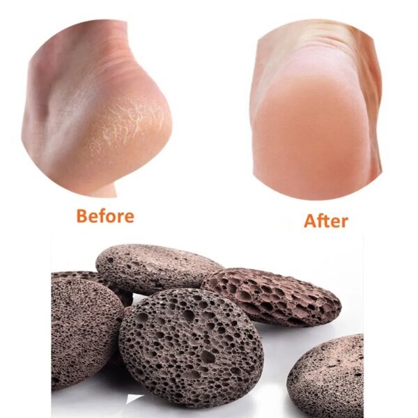 Foot Scrubber Pumice Stone - Image 2